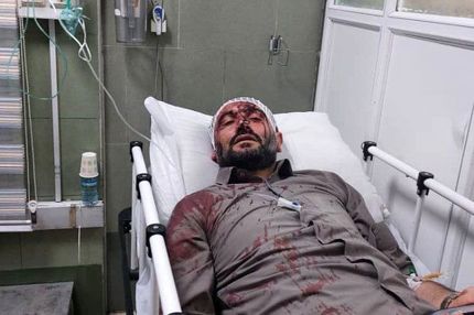 حمله مسلحانه به شهردار ناحیه ۳ منطقه ۱۹ تهران / زاکانی پیگیر مجازات عاملین این حادثه